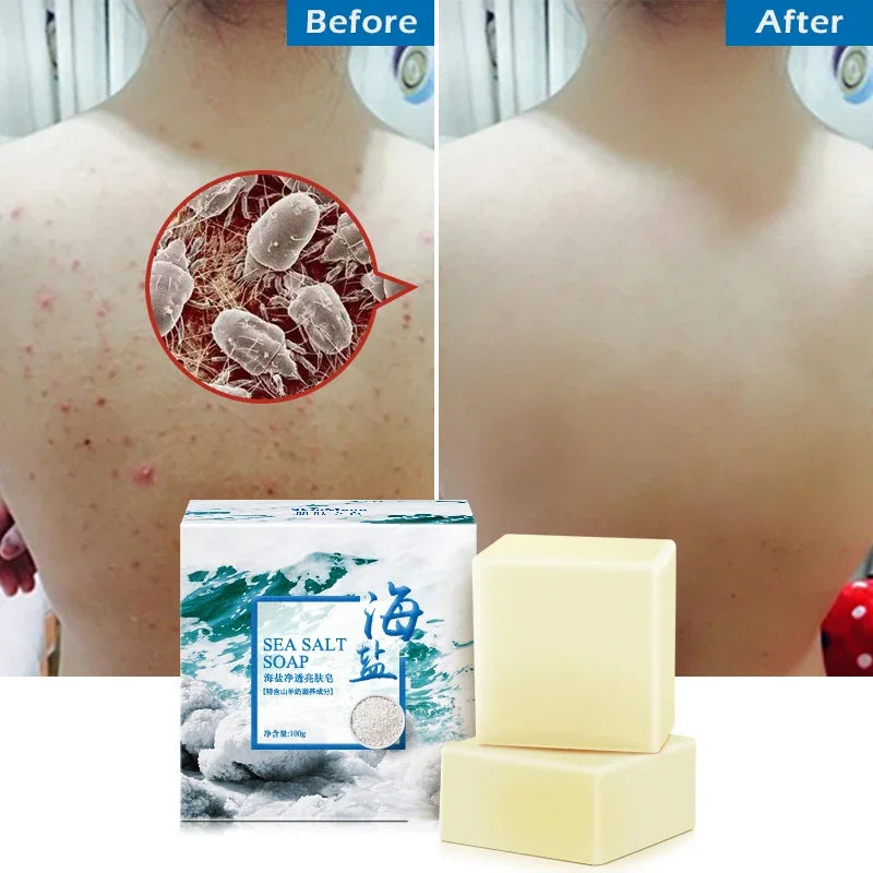 Sea Salt Soap Whitening Moisturizing Wash Base Removal Pimple Pores Acne Treatment