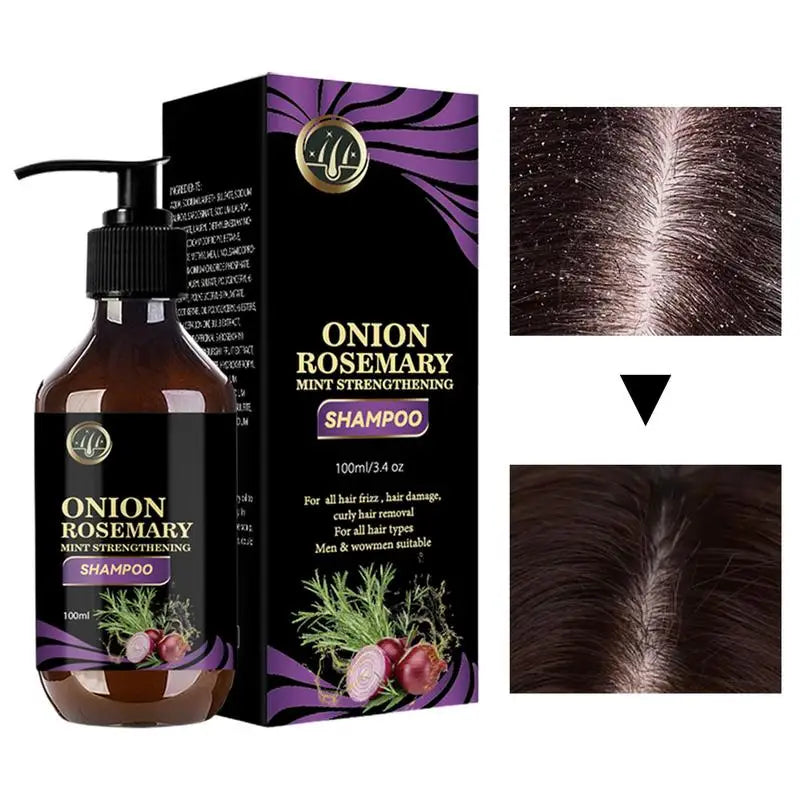 Rosemary & Onion Hair Growth Shampoo - Deep Cleansing Volumizing Formula for