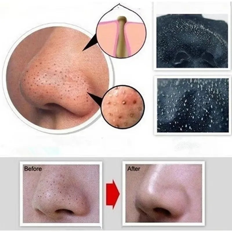 PWYUMAN Bamboo Charcoal Blackhead Remover Mask - Deep Pore Cleansing & Acne
