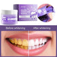 5 Days Teeth Whitening Powder Remove Plaque Stains Dental Calculus Oral Hygiene