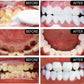 5 Days Teeth Whitening Powder Remove Plaque Stains Dental Calculus Oral Hygiene
