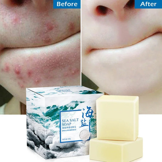 Sea Salt Soap Whitening Moisturizing Wash Base Removal Pimple Pores Acne Treatment