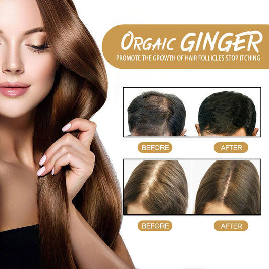 Natural Ginger Shampoo Soap - Hair Loss Prevention & Dandruff Control